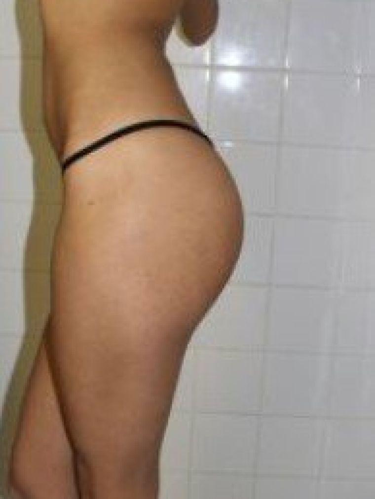 hooker Cinna (Toronto)